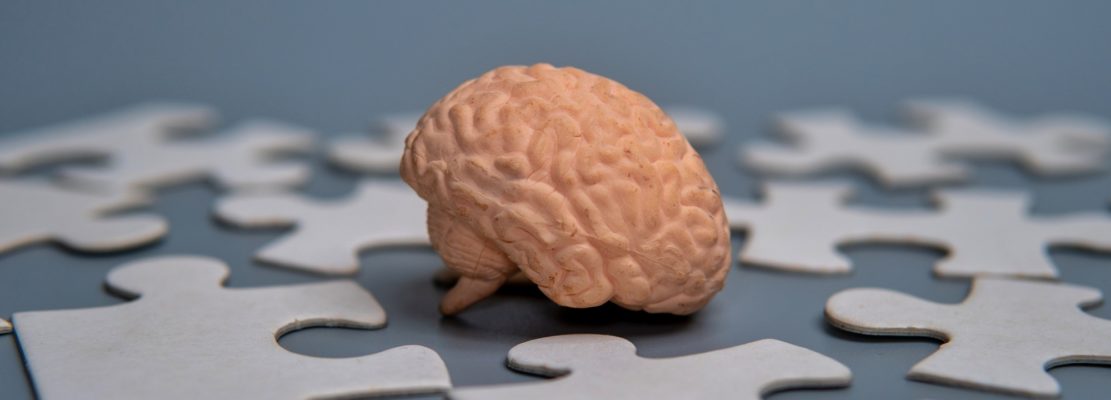 Model of a human brain surrounded by scattered puzzle pieces.